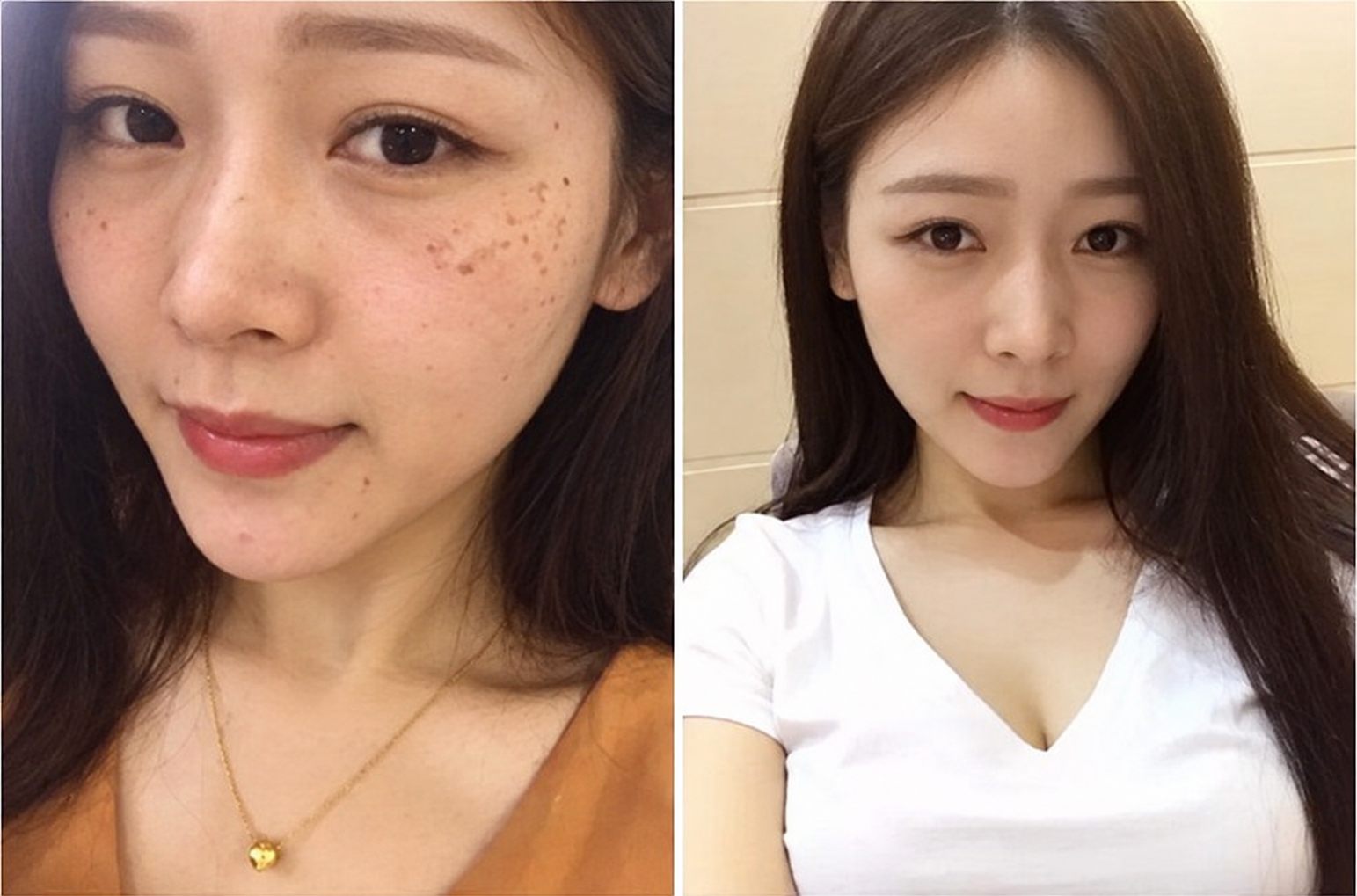 사촌 동생 웨이웨이의 기미·잡티 피부